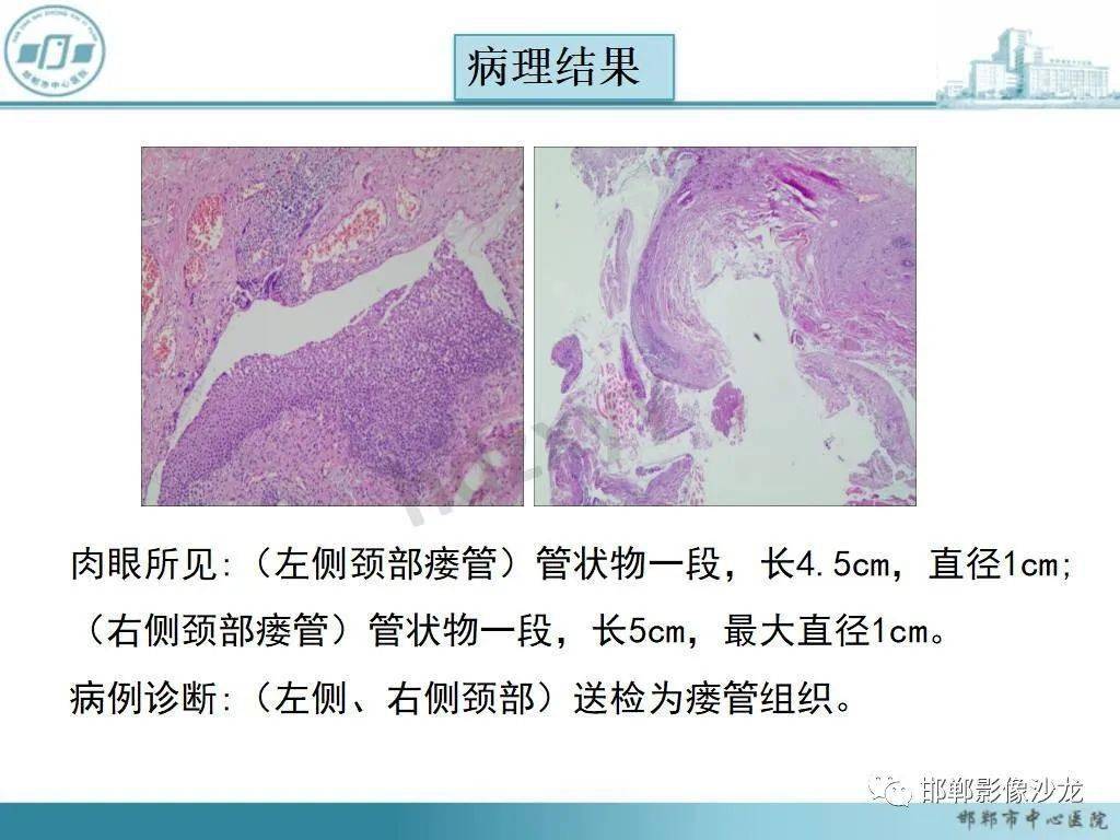 耳郭和耳廓的區(qū)別_區(qū)別耳廓耳郭的標(biāo)志_耳廓和耳郭的區(qū)別