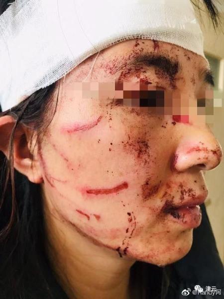 醉酒打妻子被反殺_男子醉酒殺妻_醉酒殺妻是故意還是過失