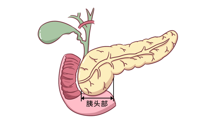 肝膽相照意思是什么_肝膽照應的意思_是肝膽相照的義氣