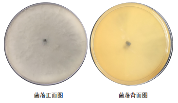 細菌構成的生命系統結構層次_細菌構成細胞的結構特點_細菌由什么構成