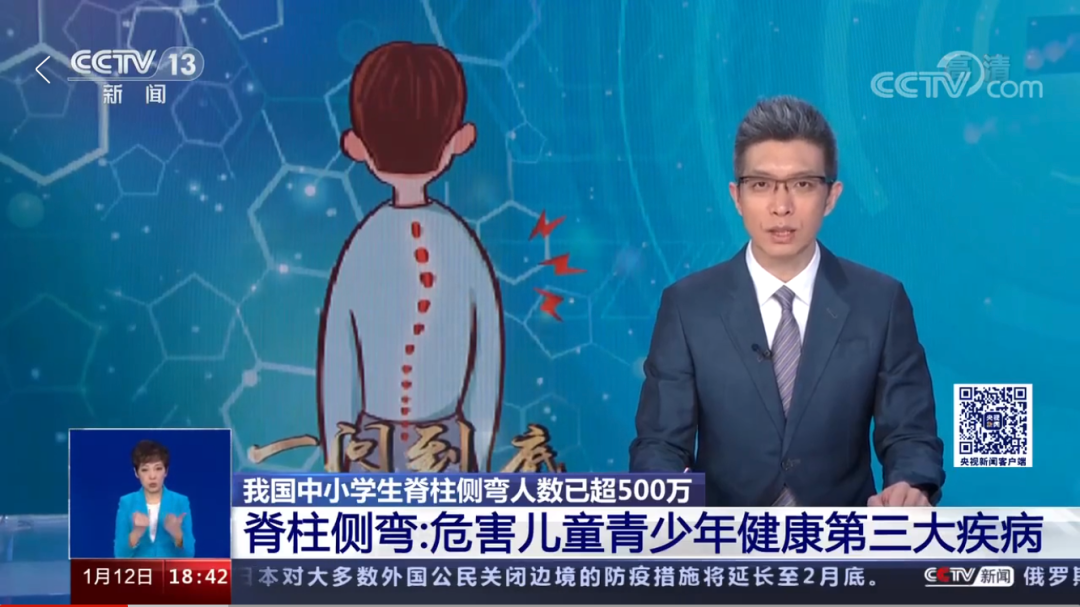 脊柱側(cè)彎已納入學(xué)生體檢_脊柱側(cè)彎會(huì)寫入體檢表嗎_學(xué)校體檢脊柱側(cè)彎
