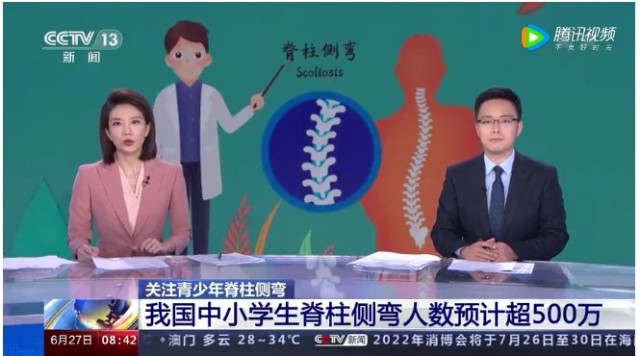 脊柱側(cè)彎已納入學(xué)生體檢_脊柱側(cè)彎會(huì)寫入體檢表嗎_學(xué)校體檢脊柱側(cè)彎